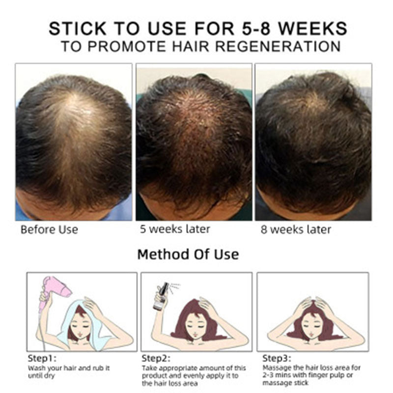 Hair Growth Oil Hair Growth Oil Oem Hair Care Essential Oil - Lumina shop