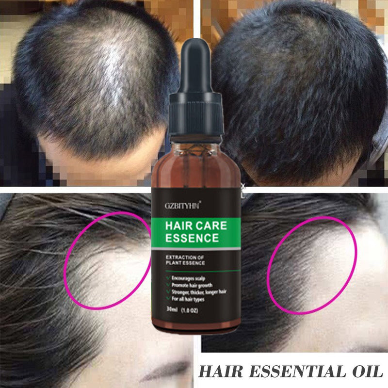 Hair Growth Oil Hair Growth Oil Oem Hair Care Essential Oil - Lumina shop