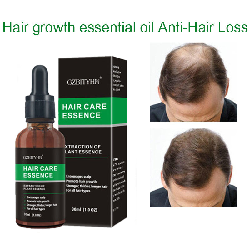 Hair Growth Oil Hair Growth Oil Oem Hair Care Essential Oil - Lumina shop