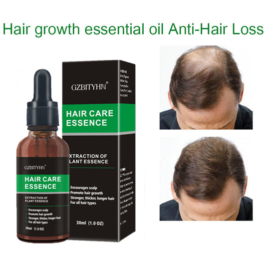 Hair Growth Oil Hair Growth Oil Oem Hair Care Essential Oil - Lumina shop