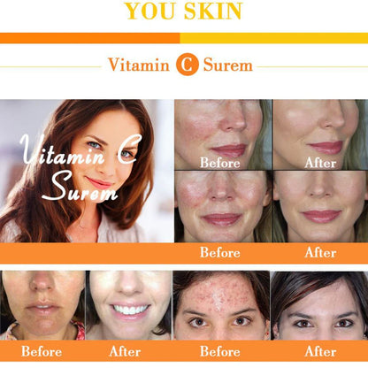 Natural Whitening Facial Serum for Moisturizing Skin | Luminashop